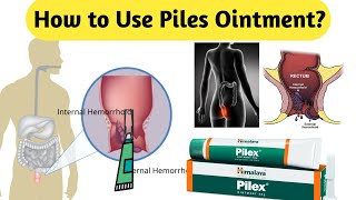 How to Use Piles Ointment [upl. by Bedwell953]