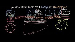 Acidocétose diabétique  Famine de Surabondance  Partie 1  Docteur Synapse [upl. by Portingale397]