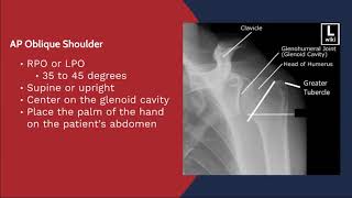 Xray Positioning and Evaluation  AP Oblique Shoulder [upl. by Wareing]