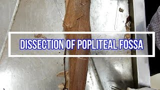 Dissection of Popliteal Fossa [upl. by Carin]