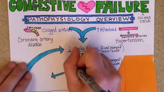 Congestive Heart Failure Pathophysiology [upl. by Asaeret]